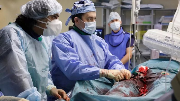 В Алматы провели операции по имплантации эндоваскулярного аортального клапана MyVal™